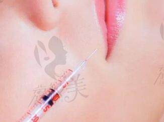 锦波生物三型胶原蛋白一般多少钱