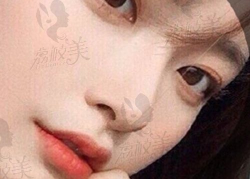 重庆当代王旭明修复鼻子怎么样？