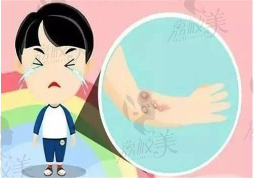 王友彬医生技术特点