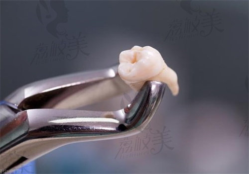 福州美可普口腔医院拔牙怎么样