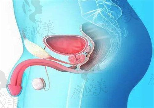 杭州阿波罗黄以政做阴茎支撑手术多少钱