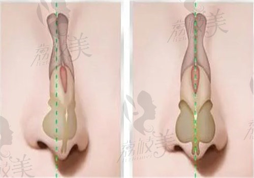 福州耳软隆鼻医院排名