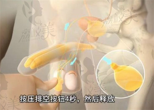 杭州阿波罗医院邓刚医生简介