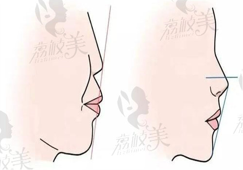肖林正颌手术价格表