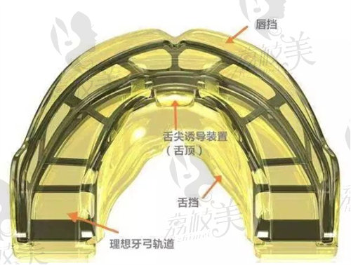 海宁牙博士口腔温晔晔做儿童早期干预矫正