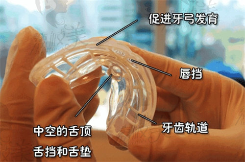 海宁牙博士口腔温晔晔做儿童早期干预矫正