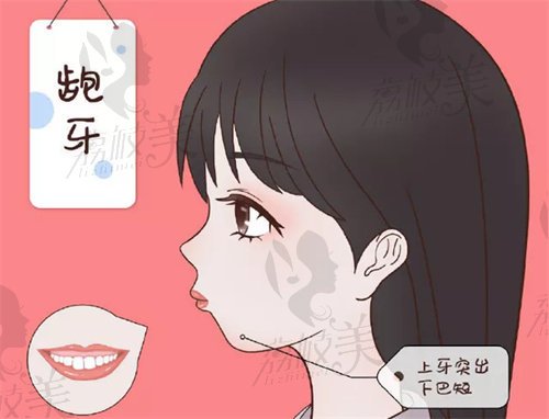 沈陽杏林朱石江骨性凸嘴矯正