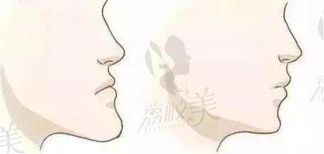 赤壁维乐口腔预约挂号