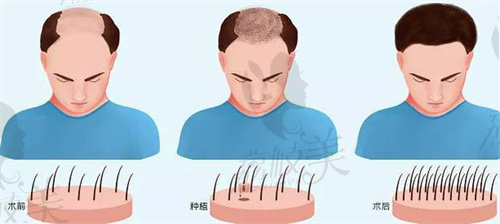 章光101和章光瑞丝有什么区别