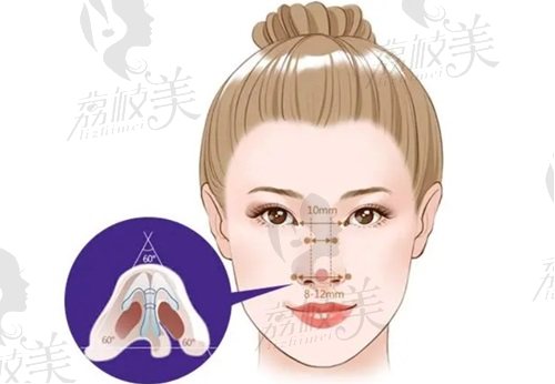 上海联合丽格范荣杰初鼻半肋综合价格