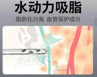 重庆大腿环吸哪家医院做得好