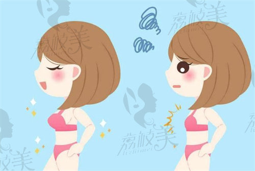 重慶華美陳德法做縮胸手術(shù)