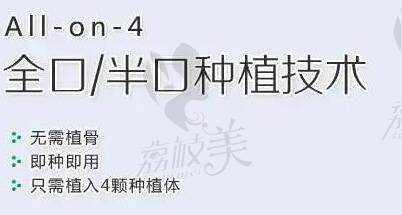 西安双宝口腔种牙价格