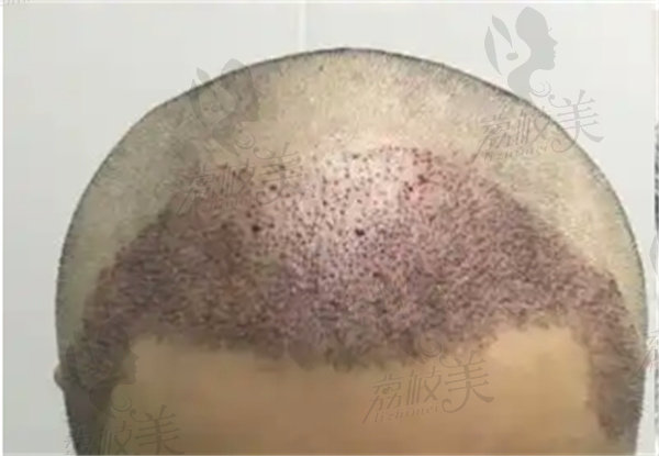 手术过程全记录