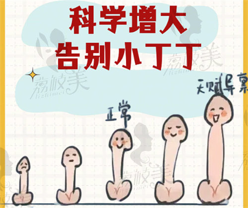 杭州阿波罗邓刚做阴茎延长