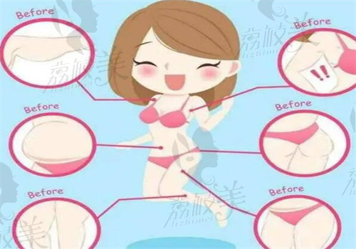 上海安缦刘思达做吸脂整形手术相关优势