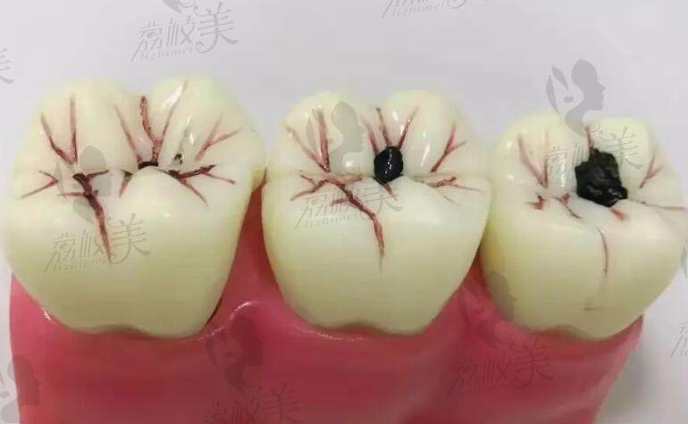 上海志琴口腔价格