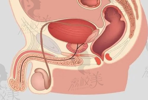 重慶李世榮做陰莖延長增粗術(shù)靠譜嗎？