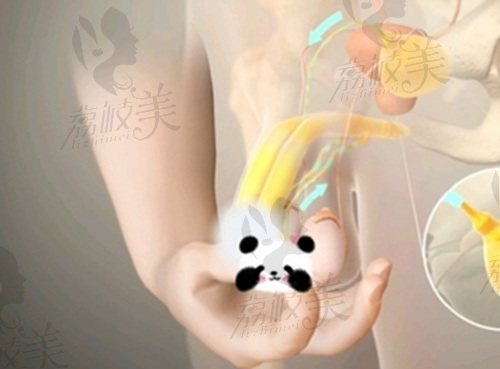 重慶李世榮做陰莖延長增粗術(shù)靠譜嗎？