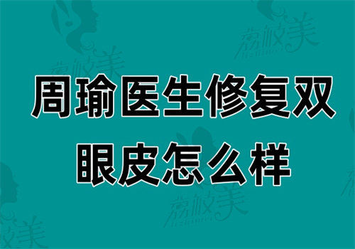 周瑜医生修复双眼皮怎么样
