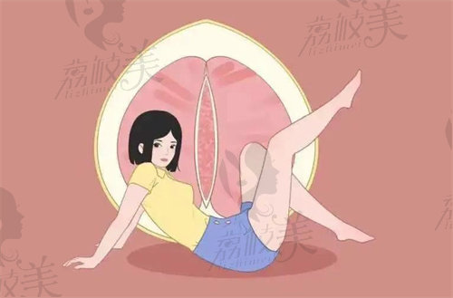妇科紧缩手术值得做吗