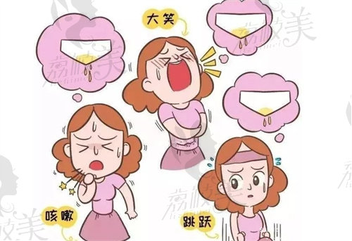 妇科紧缩手术值得做吗