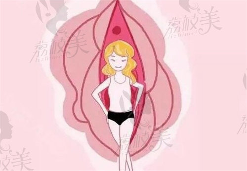 妇科紧缩手术值得做吗