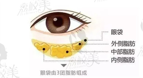 上海张晋宝不开刀去眼袋是真的吗