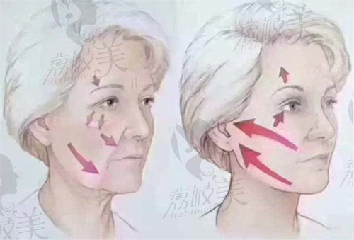 长沙迦美刘志刚做人鱼美雕面部塑形