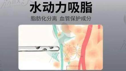 冯斌吸脂整形价格表