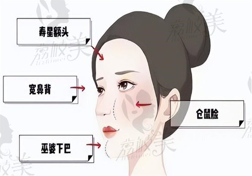 北京任冲川字纹手术多少钱