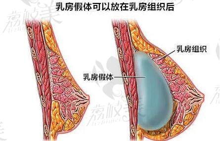 上海美莱唐毅有资质吗