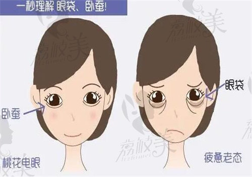 赤峰松山德康医院刘星赫做异体皮瓣卧蚕成形术手术多少钱