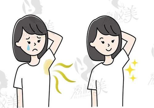 深圳源美朱志祥做去腋臭手术相关优势