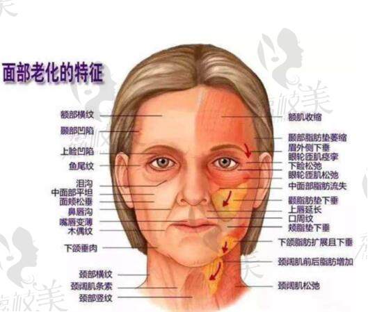 北京八大处面部提升哪个医生好