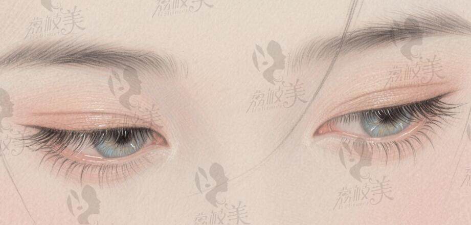 高寿松双眼皮修复价格