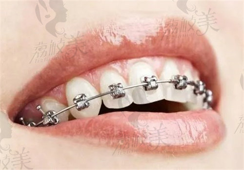 <span style=