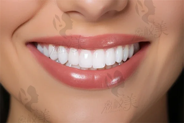 牙齿矫正后怎么护理才能减少危害？
