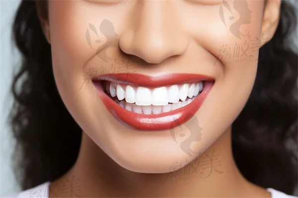 牙龈整形的方法有哪些