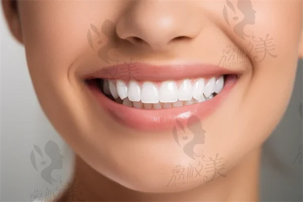 牙粉美白牙齿会损伤牙齿吗