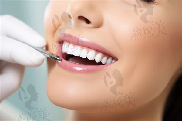 【牙齿】牙菌斑牙龈出血是什么原因？