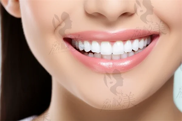 【镶牙】镶牙后如何正确的保养牙齿？