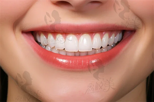 【洗牙】洗牙的禁忌症和适应症有哪些？