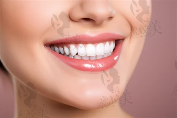 冷光美白牙齿对牙齿有什么伤害吗？