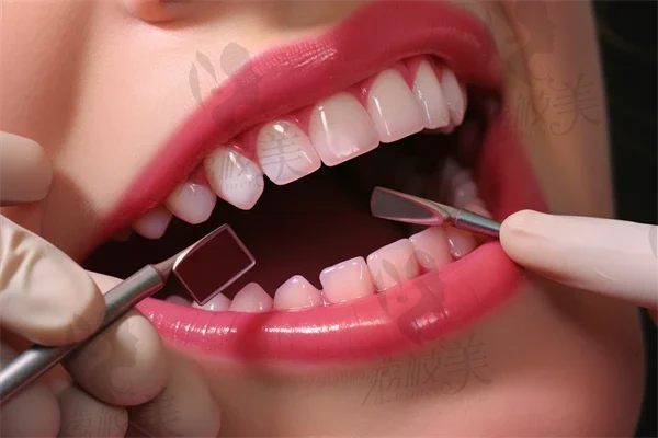 【种植牙】种植牙对身体健康有没有危害呢？
