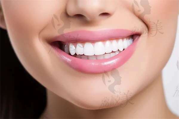 种植牙和镶牙两者有什么不同？