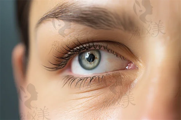 病毒性结膜炎眼睛发痒正常吗