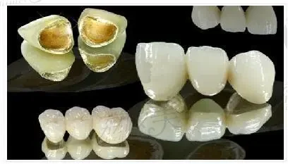 惠州种植牙口腔医院哪家好？热门项目技术优势及价位