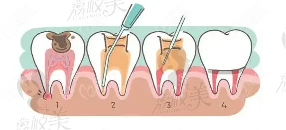 江西口腔医院排行前十简介，汇总10家口碑技术好的医院&附价格表