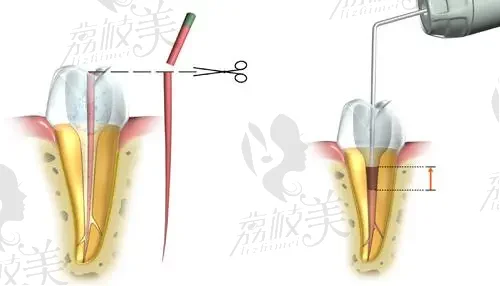 西安口碑点赞口腔医院排行榜，排名前十公/私立医院+2023价格表公布